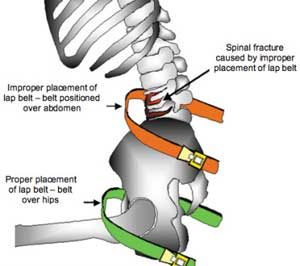 proper seat belt position