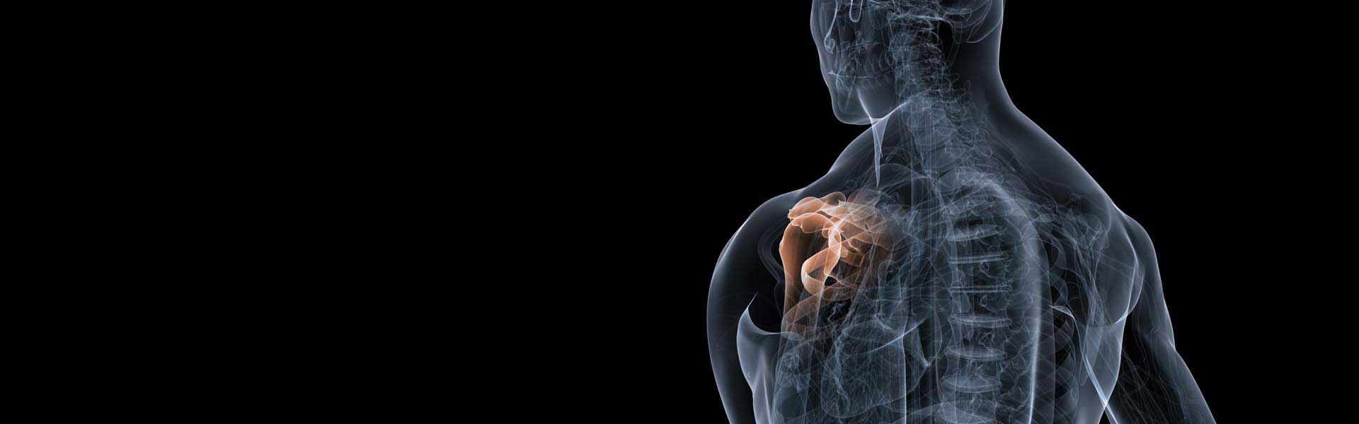 shoulder injuries from car accident