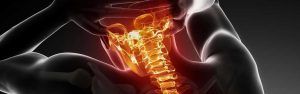 neck pain after car accident