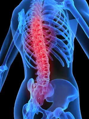 back pain after car accident